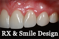 RX & Smile Design200